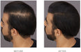 Toppik Hair Building Fibers Before and After