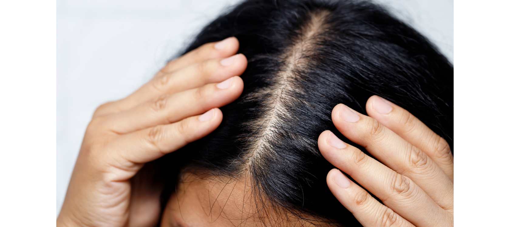 Thinning Hair: Why it Happens, How to Identify it, and How to Treat it
