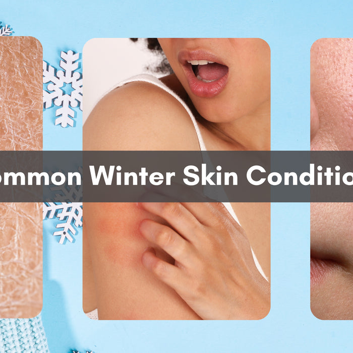 Unraveling Winter’s Skin Woes: Understanding Common Cold-Weather Skin Conditions
