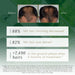 88% felt hair thinning decreased and 82% felt hair was denser in a usage test of 112 men with progressive hair thinning after 3 months of use.