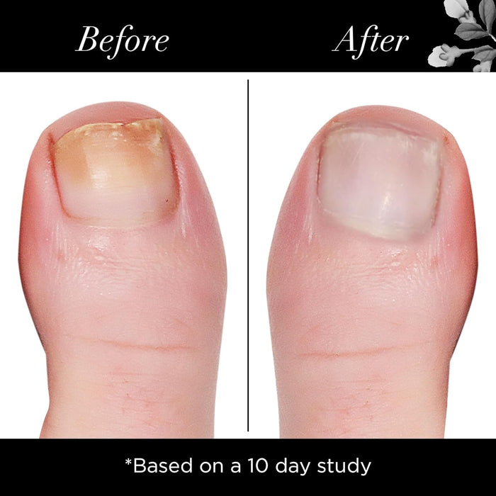 Butter LONDON Mellow The Yellow Nail Brightening Treatment 0.4 fl oz