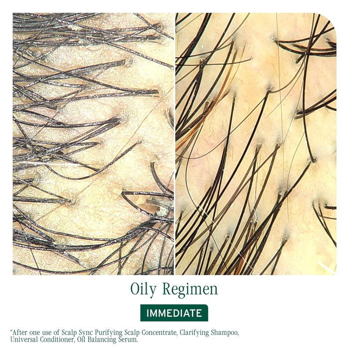 Biolage Scalp Sync Oil Balancing Serum