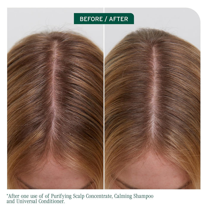 Before and after using Biolage Scalp Sync Clarifying Shampoo