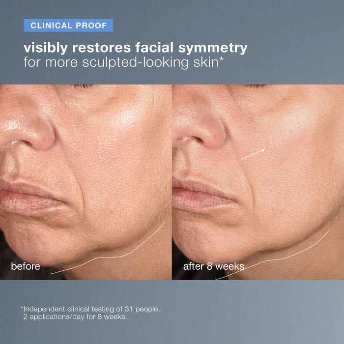 Before and after comparison of facial symmetry with text indicating clinical proof.