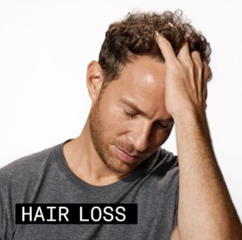 Hair Loss