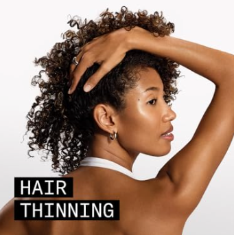 Hair Thinning