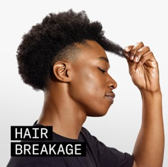 Hair Breakage
