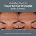 Dermalogica Age Smart Dynamic Skin Recovery SPF 50 is clinically proven to reduce the look of wrinkles within 8 weeks according to an independent study on 33 subjects with 1 application a day for 8 weeks