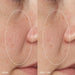 Dermalogica Liquid Peelfoliant before and after 1 use