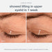 Clinical proof: showed lifting in upper eyelid in 1 week.