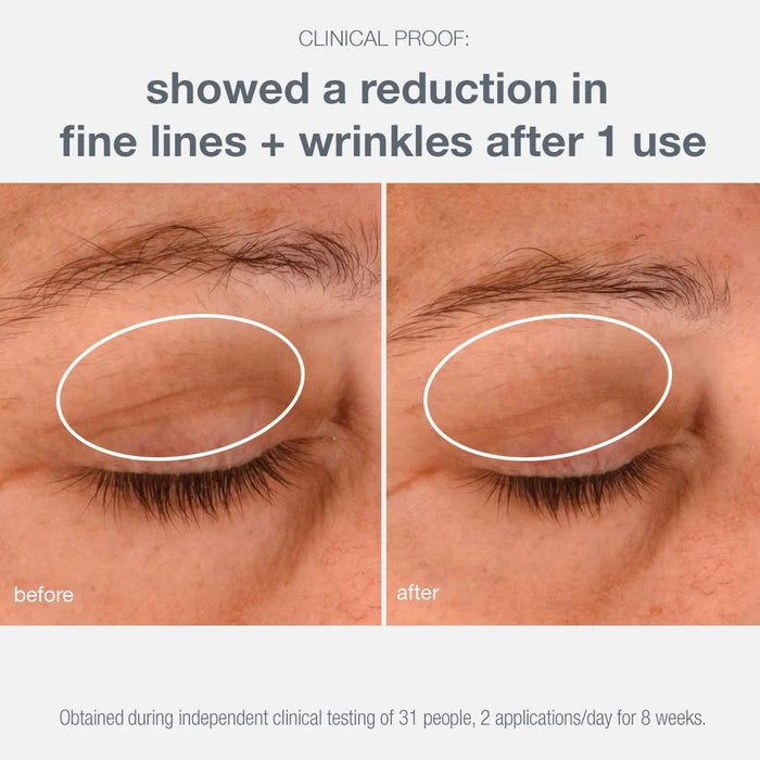 clinical proof: showed a reduction in fine lines + wrinkles after 1 use.