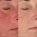 before and after 28 days of use of Dermalogica Stabilizing Repair Cream. Noticeably less redness after 28 days of use