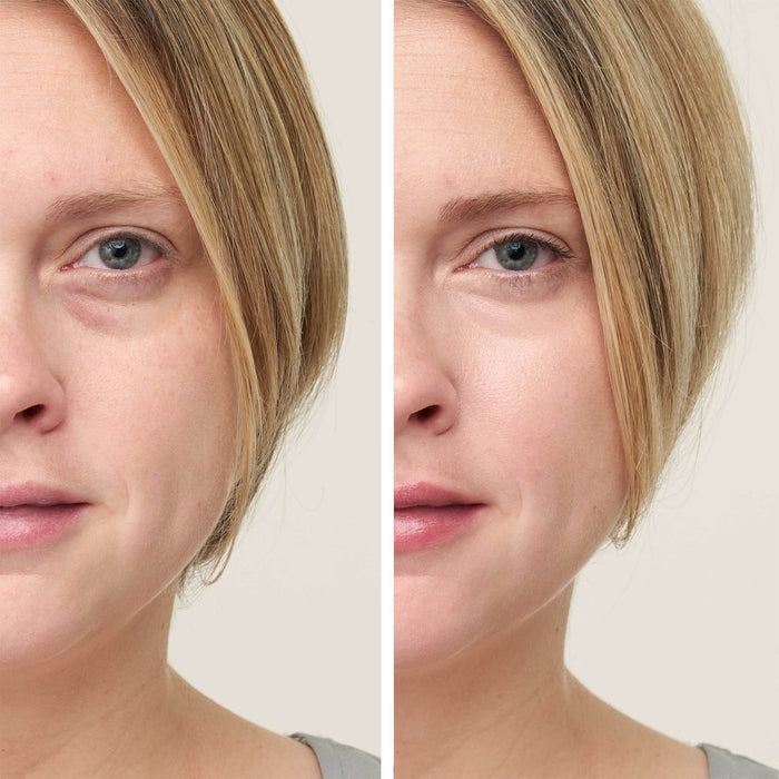Jane Iredale Circle\Delete Concealer Before and After
