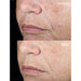 Dermalogica Active Clearing Retinol Clearing Oil Before and After