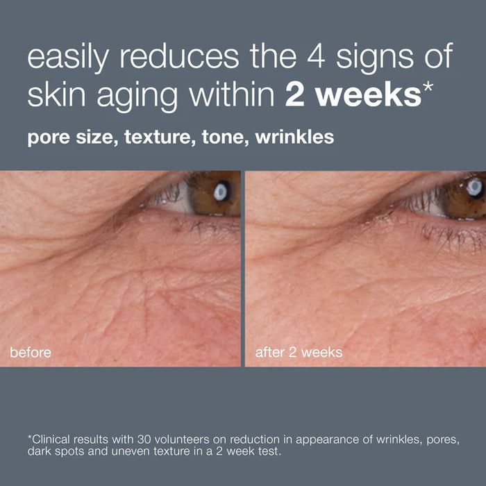 Dermalogica Dynamic Skin Retinol Serum can reduce the 4 signs of skin aging with 2 weeks. Pore size, texture, tone, wrinkles